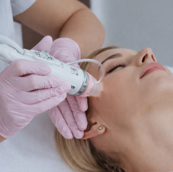 Microneedling